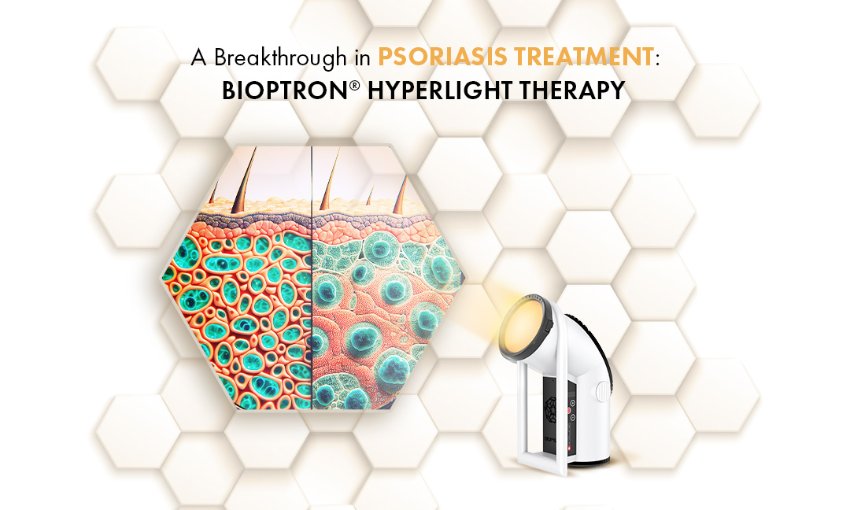 Ein Durchbruch in der Psoriasis-Behandlung: Bioptron® Hyperlight Therapy
